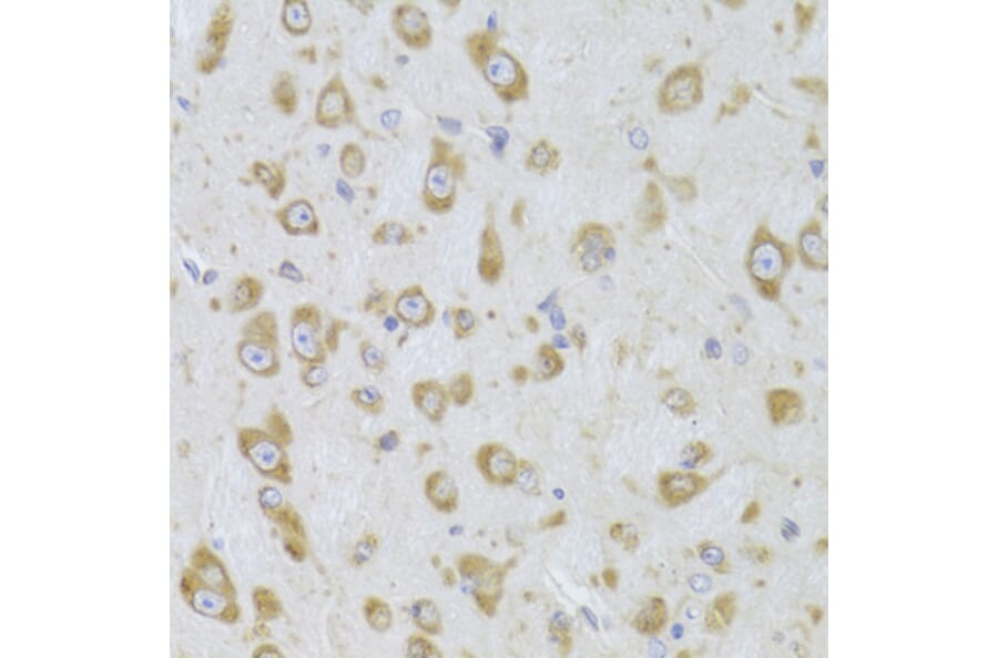 Immunohistochemistry - Anti-eEF1B2 Antibody (A15285) - Antibodies.com