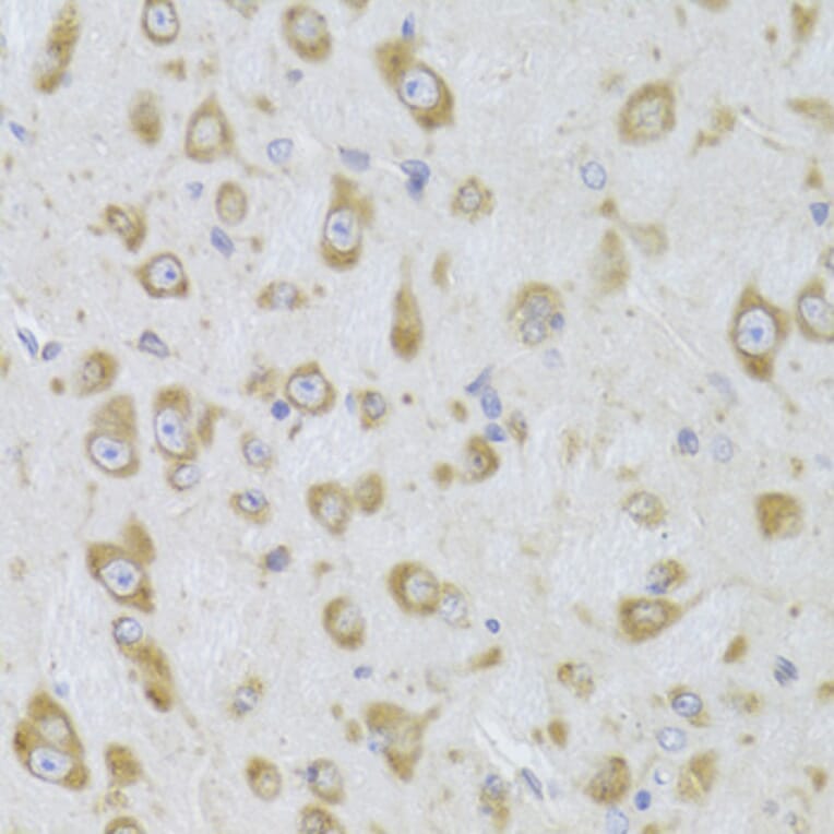 Immunohistochemistry - Anti-eEF1B2 Antibody (A15285) - Antibodies.com
