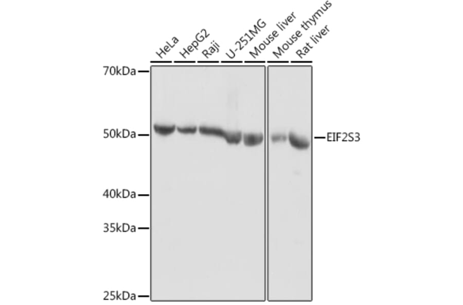 Western Blot - Anti-EIF2G/EIF2S3 Antibody (A15286) - Antibodies.com