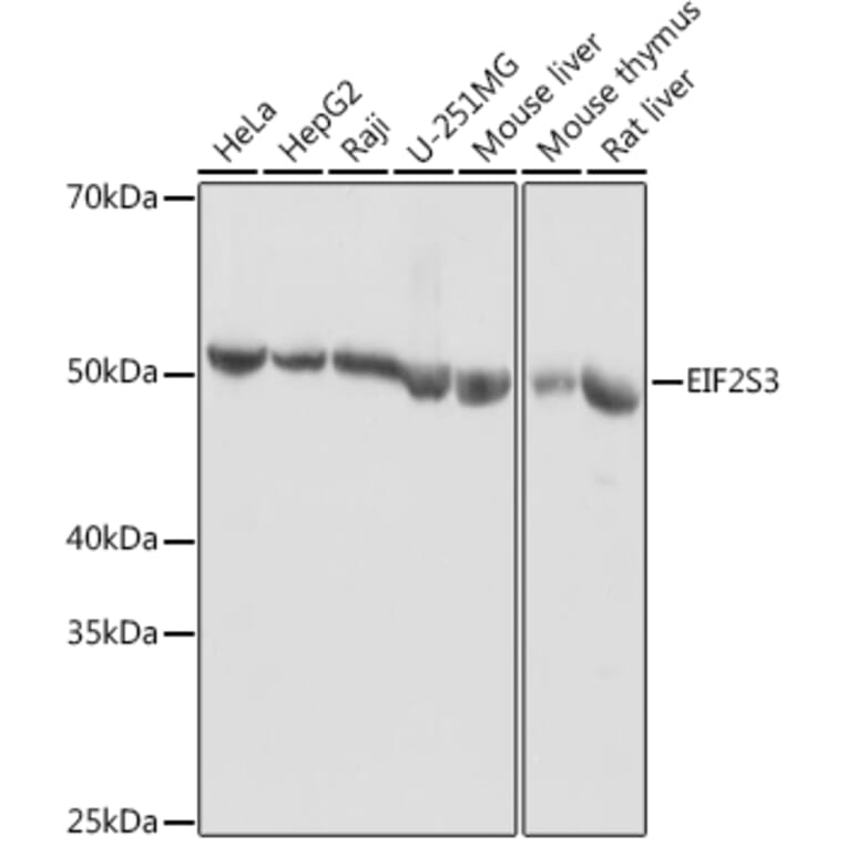Western Blot - Anti-EIF2G/EIF2S3 Antibody (A15286) - Antibodies.com