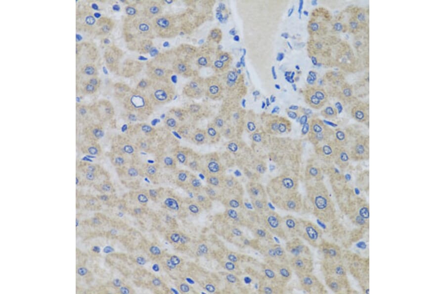 Immunohistochemistry - Anti-EIF2G/EIF2S3 Antibody (A15286) - Antibodies.com