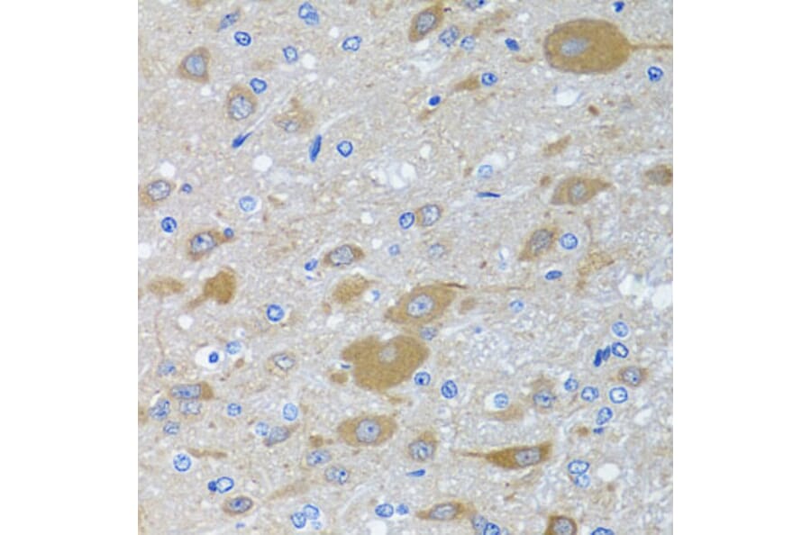 Immunohistochemistry - Anti-EIF2G/EIF2S3 Antibody (A15286) - Antibodies.com