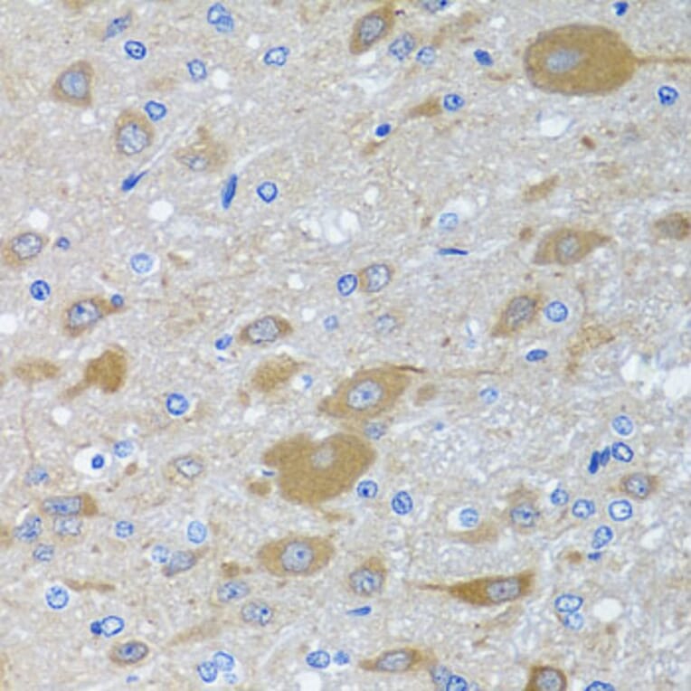 Immunohistochemistry - Anti-EIF2G/EIF2S3 Antibody (A15286) - Antibodies.com