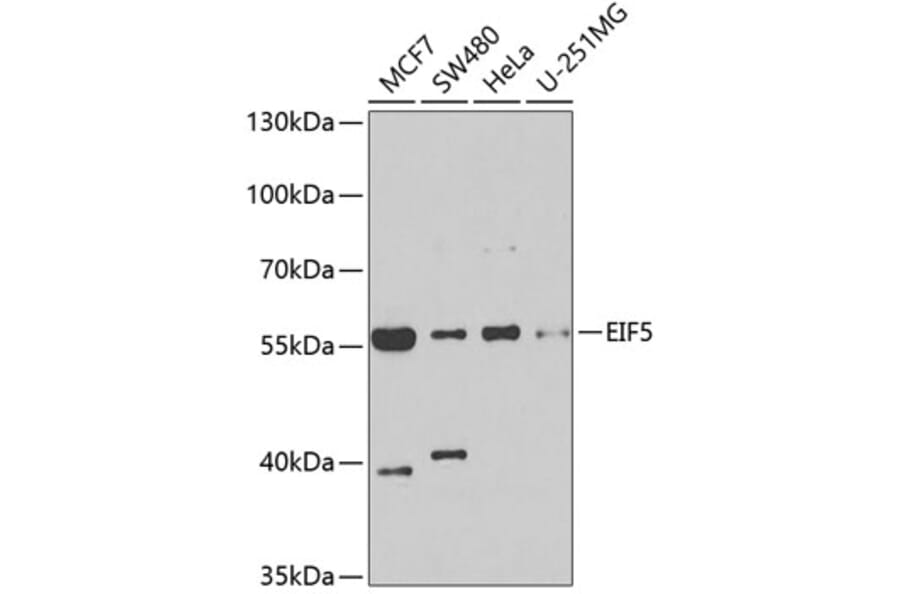 Western Blot - Anti-EIF5 Antibody (A15287) - Antibodies.com
