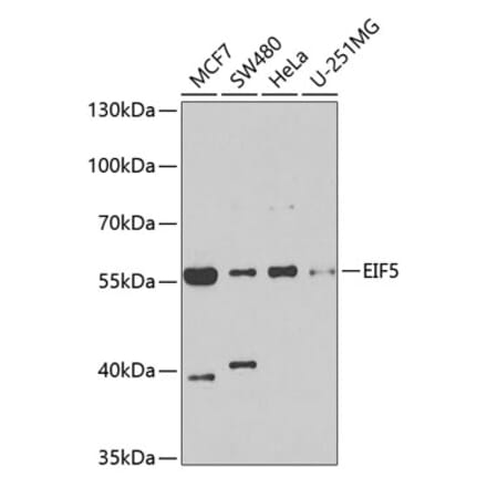 Western Blot - Anti-EIF5 Antibody (A15287) - Antibodies.com