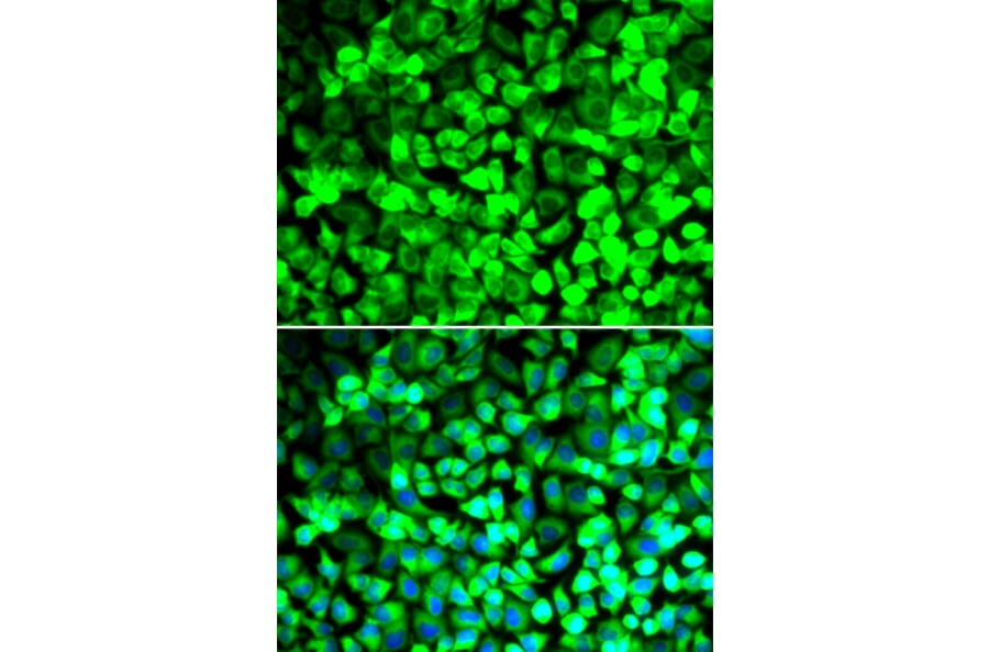 Immunofluorescence - Anti-EIF5 Antibody (A15287) - Antibodies.com