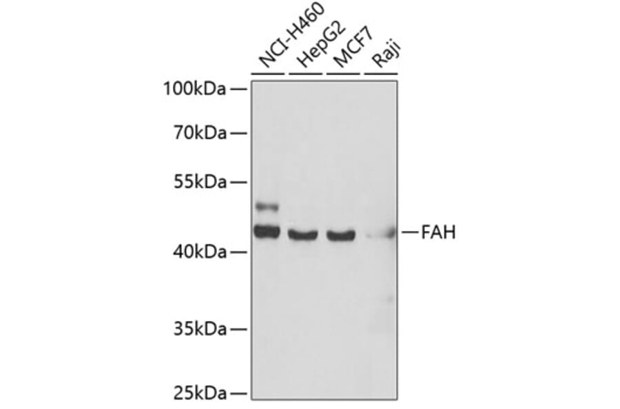 Western Blot - Anti-Fumarylacetoacetate hydrolase/FAA Antibody (A15288) - Antibodies.com