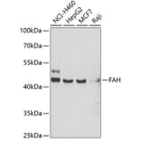 Western Blot - Anti-Fumarylacetoacetate hydrolase/FAA Antibody (A15288) - Antibodies.com