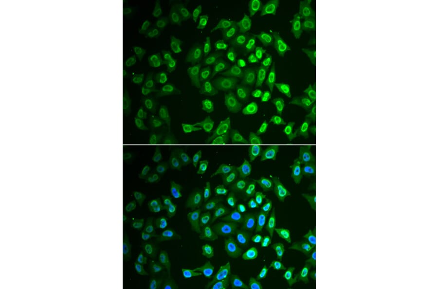 Immunofluorescence - Anti-Fumarylacetoacetate hydrolase/FAA Antibody (A15288) - Antibodies.com