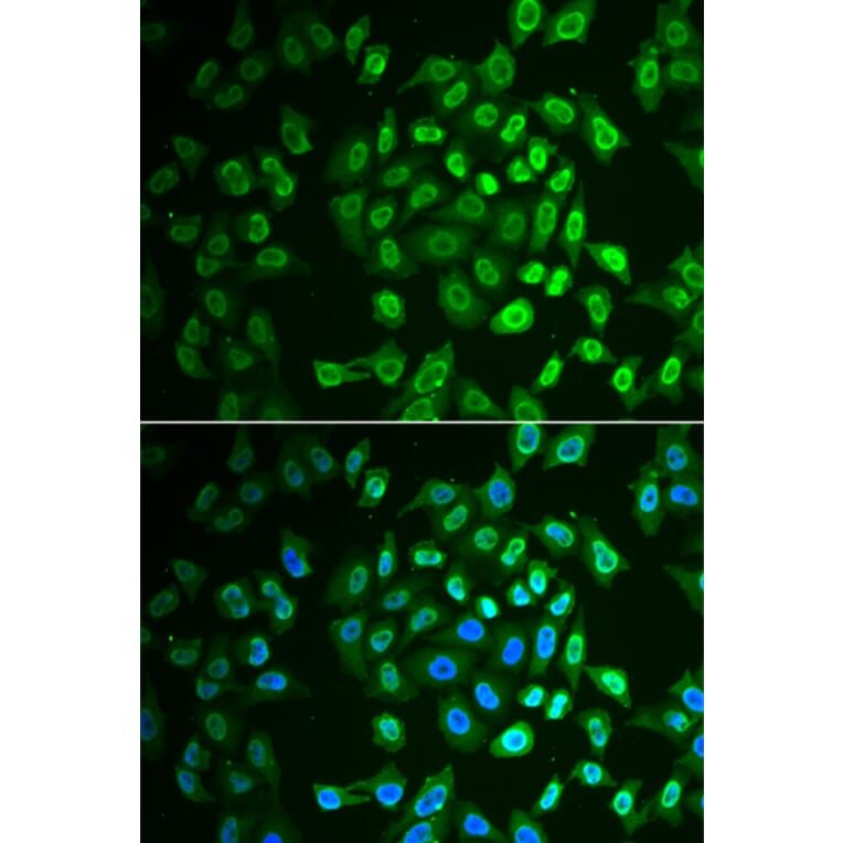 Immunofluorescence - Anti-Fumarylacetoacetate hydrolase/FAA Antibody (A15288) - Antibodies.com