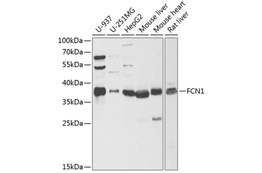 Western Blot - Anti-FCN1/M-Ficolin Antibody (A15289) - Antibodies.com
