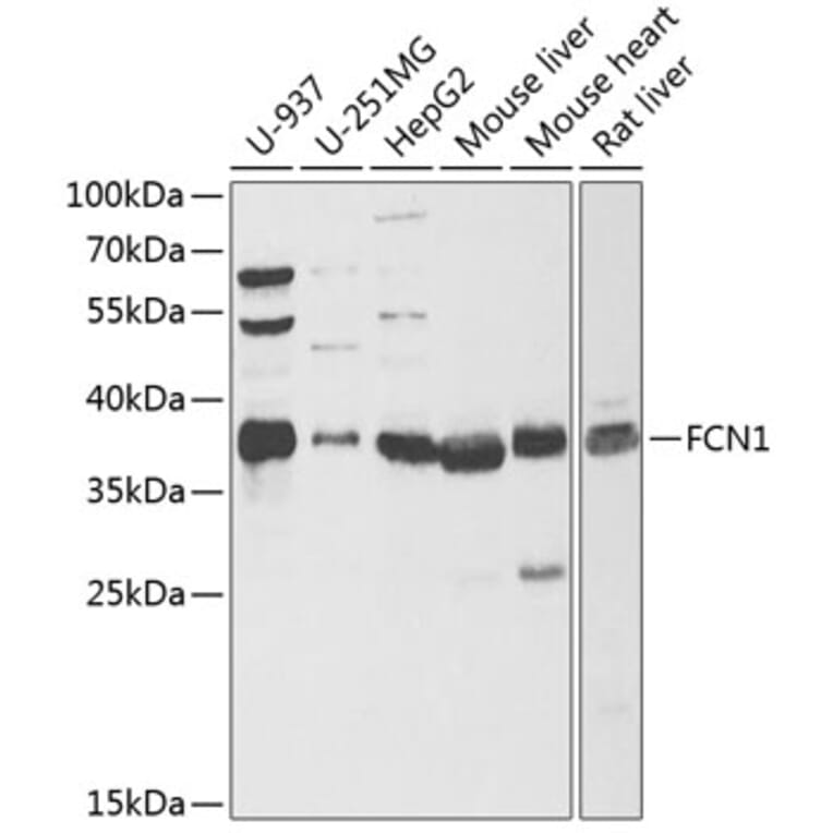 Western Blot - Anti-FCN1/M-Ficolin Antibody (A15289) - Antibodies.com