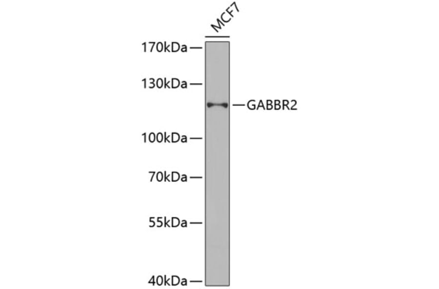 Western Blot - Anti-GABBR2 Antibody (A6594) - Antibodies.com