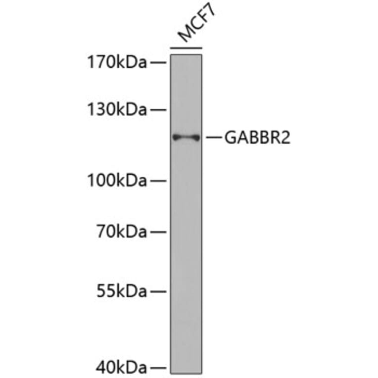 Western Blot - Anti-GABBR2 Antibody (A6594) - Antibodies.com
