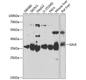 Western Blot - Anti-GALE Antibody (A15294) - Antibodies.com