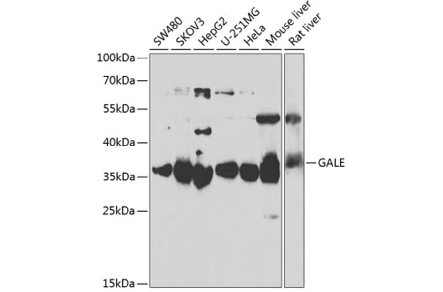 Western Blot - Anti-GALE Antibody (A15294) - Antibodies.com