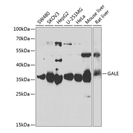 Western Blot - Anti-GALE Antibody (A15294) - Antibodies.com