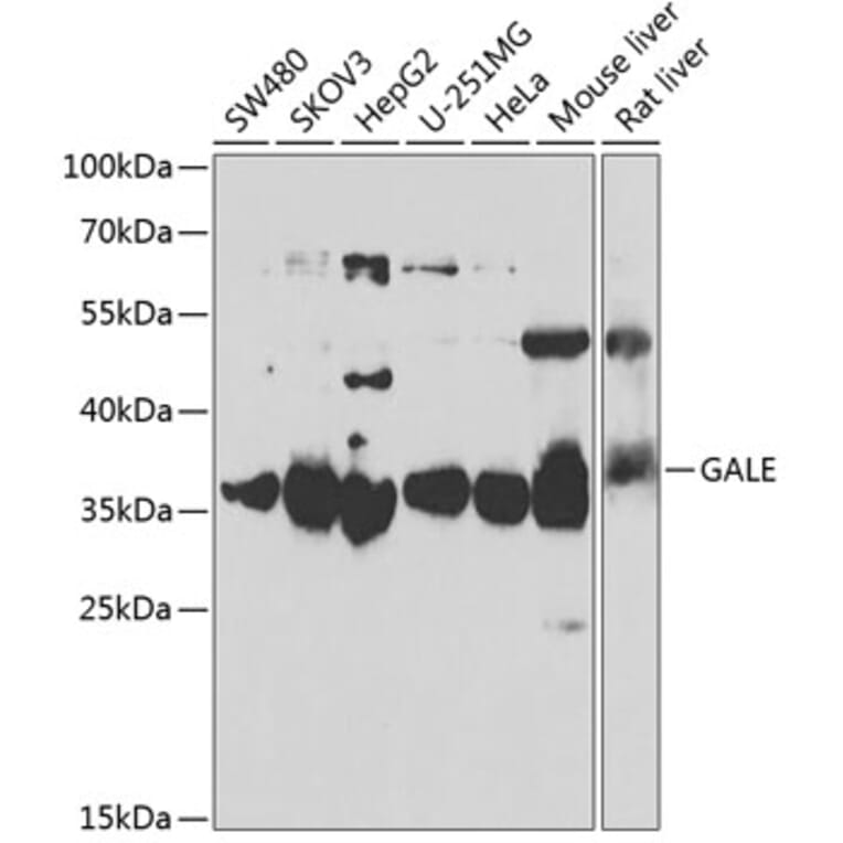 Western Blot - Anti-GALE Antibody (A15294) - Antibodies.com