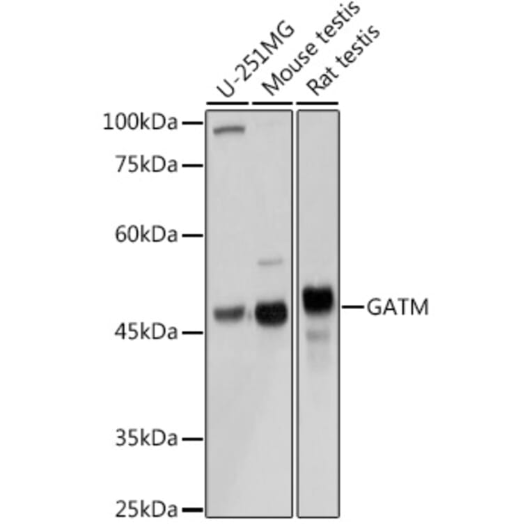Western Blot - Anti-GATM Antibody (A15295) - Antibodies.com