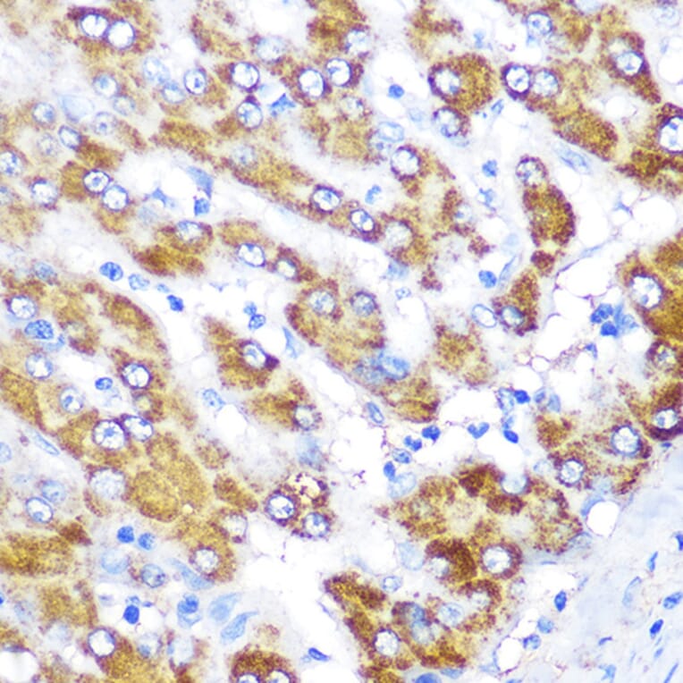 Immunohistochemistry - Anti-GATM Antibody (A15295) - Antibodies.com