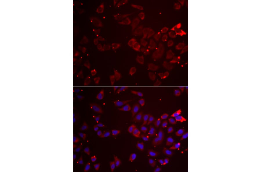 Immunofluorescence - Anti-GATM Antibody (A15295) - Antibodies.com
