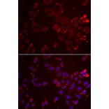 Immunofluorescence - Anti-GATM Antibody (A15295) - Antibodies.com