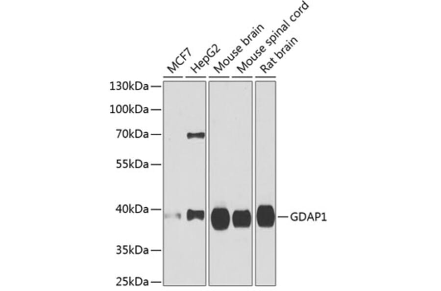 Western Blot - Anti-GDAP1 Antibody (A15296) - Antibodies.com