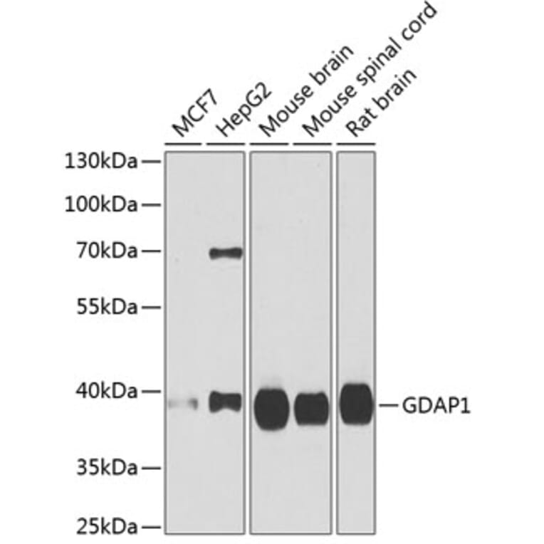 Western Blot - Anti-GDAP1 Antibody (A15296) - Antibodies.com