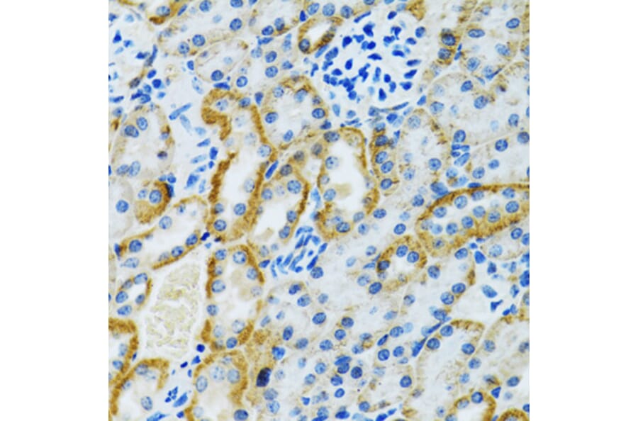 Immunohistochemistry - Anti-GDAP1 Antibody (A15296) - Antibodies.com