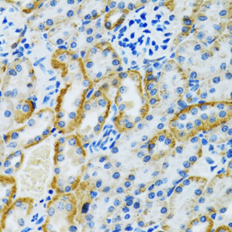 Immunohistochemistry - Anti-GDAP1 Antibody (A15296) - Antibodies.com