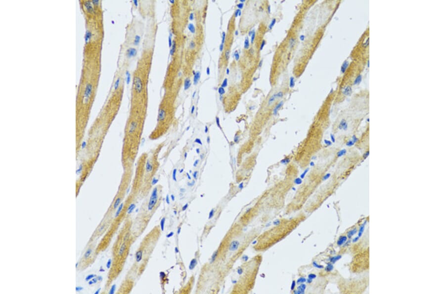 Immunohistochemistry - Anti-GDAP1 Antibody (A15296) - Antibodies.com