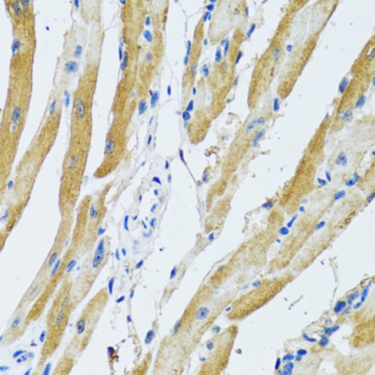 Immunohistochemistry - Anti-GDAP1 Antibody (A15296) - Antibodies.com