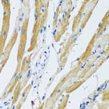 Immunohistochemistry - Anti-GDAP1 Antibody (A15296) - Antibodies.com