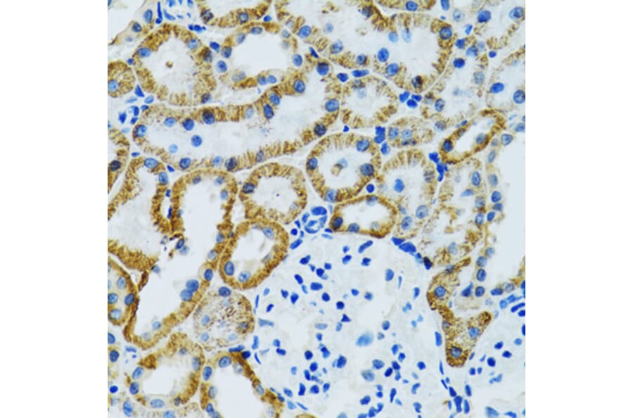 Immunohistochemistry - Anti-GDAP1 Antibody (A15296) - Antibodies.com