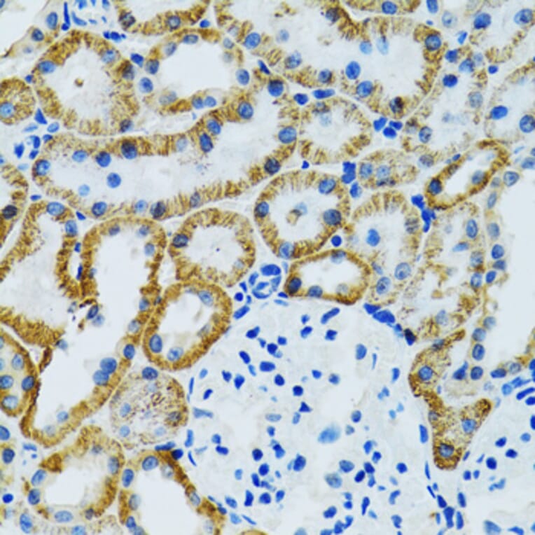 Immunohistochemistry - Anti-GDAP1 Antibody (A15296) - Antibodies.com