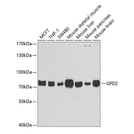 Western Blot - Anti-GPD2 Antibody (A6611) - Antibodies.com