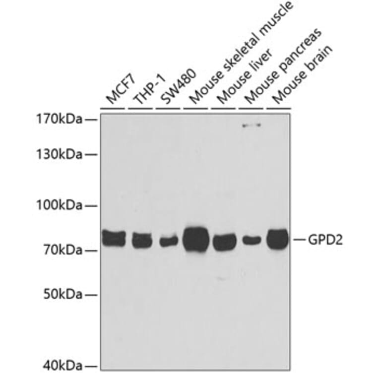 Western Blot - Anti-GPD2 Antibody (A6611) - Antibodies.com