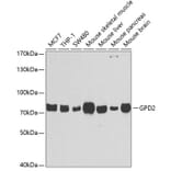 Western Blot - Anti-GPD2 Antibody (A6611) - Antibodies.com
