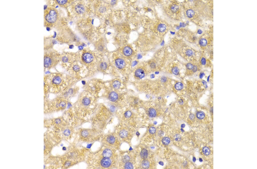 Immunohistochemistry - Anti-GPD2 Antibody (A6611) - Antibodies.com