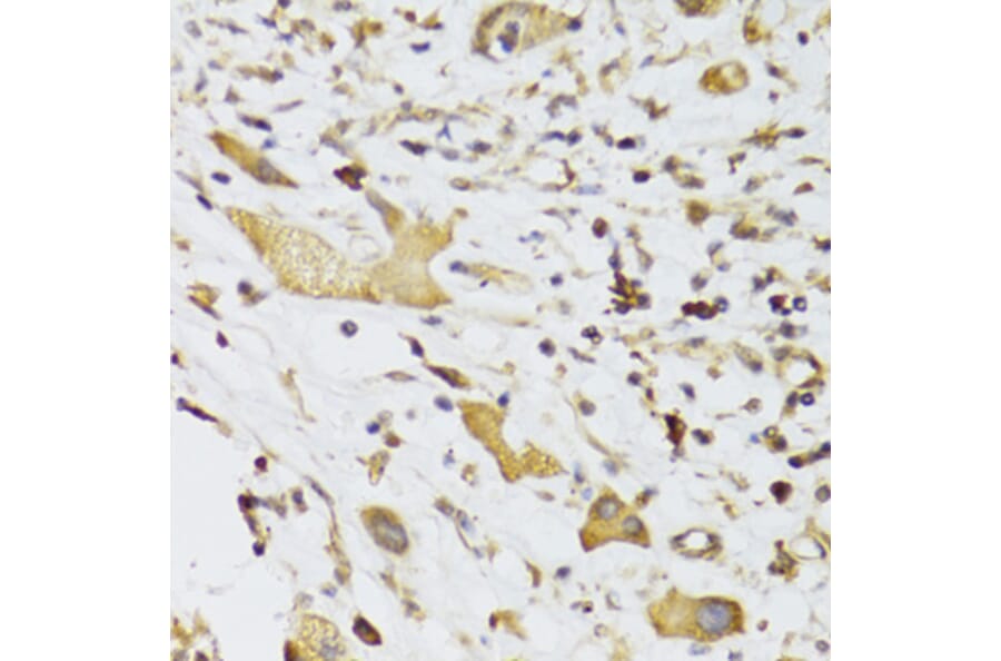 Immunohistochemistry - Anti-GPD2 Antibody (A6611) - Antibodies.com