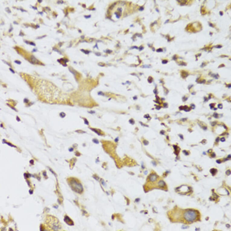 Immunohistochemistry - Anti-GPD2 Antibody (A6611) - Antibodies.com