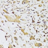 Immunohistochemistry - Anti-GPD2 Antibody (A6611) - Antibodies.com