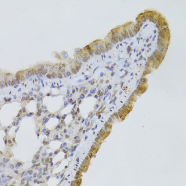 Immunohistochemistry - Anti-GPD2 Antibody (A6611) - Antibodies.com
