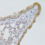 Immunohistochemistry - Anti-GPD2 Antibody (A6611) - Antibodies.com