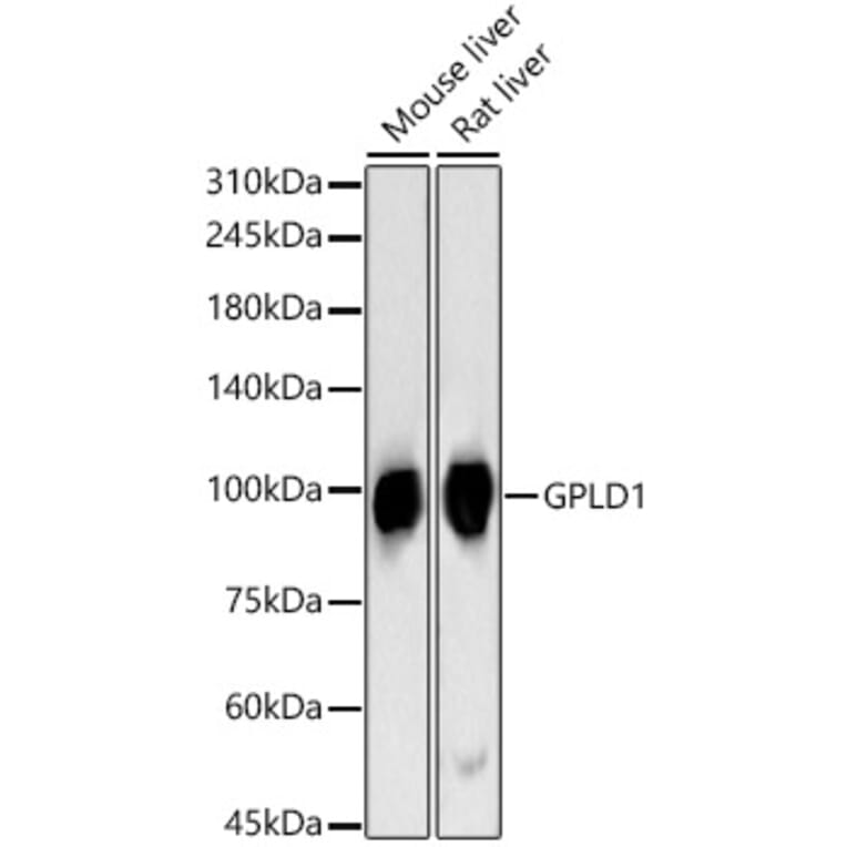 Western Blot - Anti-GPI-PLD Antibody (A15299) - Antibodies.com