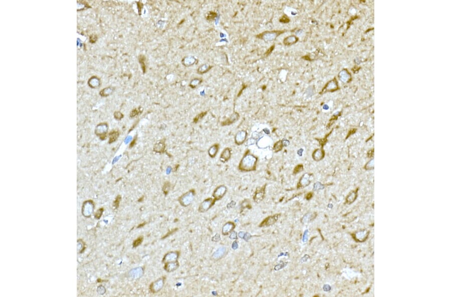 Immunohistochemistry - Anti-GPI-PLD Antibody (A15299) - Antibodies.com