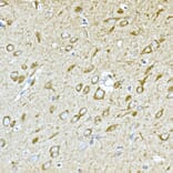 Immunohistochemistry - Anti-GPI-PLD Antibody (A15299) - Antibodies.com