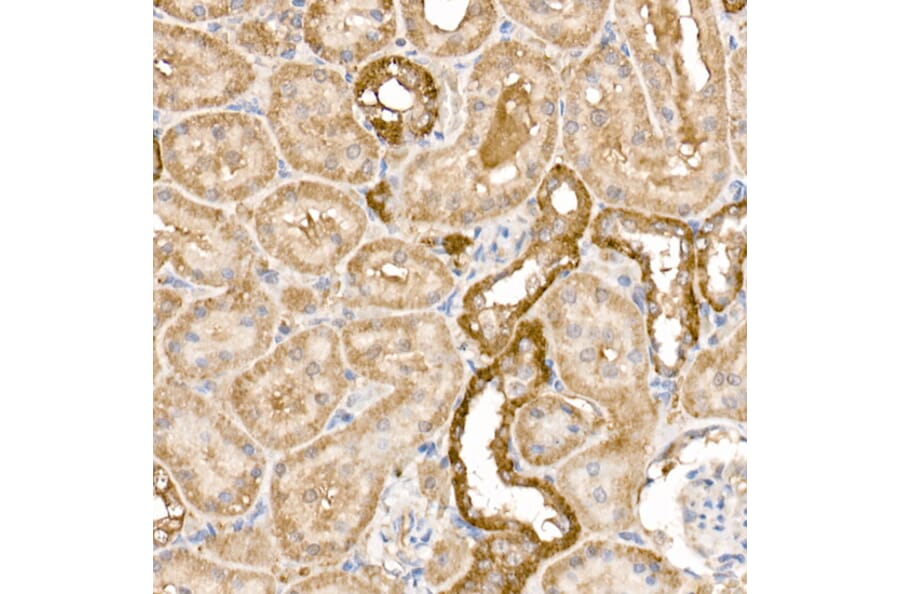 Immunohistochemistry - Anti-GPI-PLD Antibody (A15299) - Antibodies.com