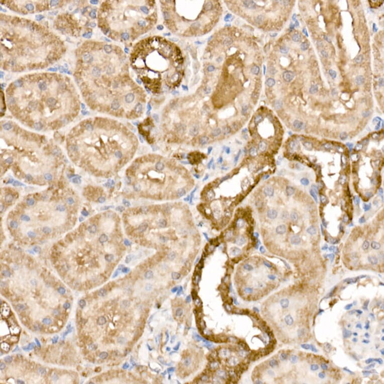 Immunohistochemistry - Anti-GPI-PLD Antibody (A15299) - Antibodies.com