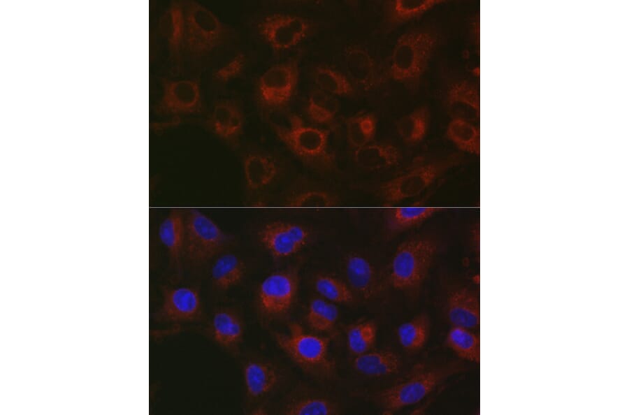 Immunofluorescence - Anti-GPI-PLD Antibody (A15299) - Antibodies.com